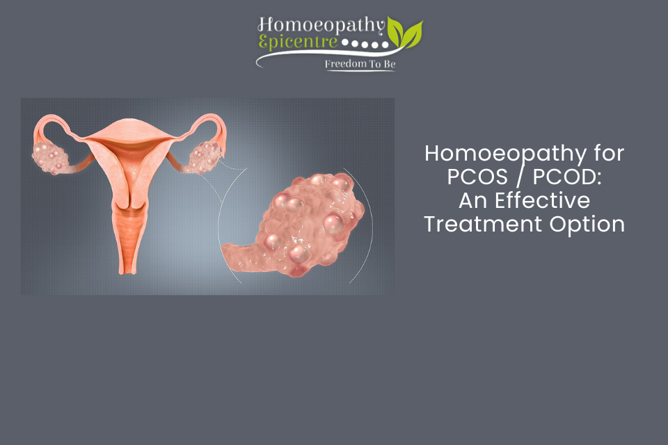 Homoeopathy for PCOS / PCOD: An Effective Treatment Option
