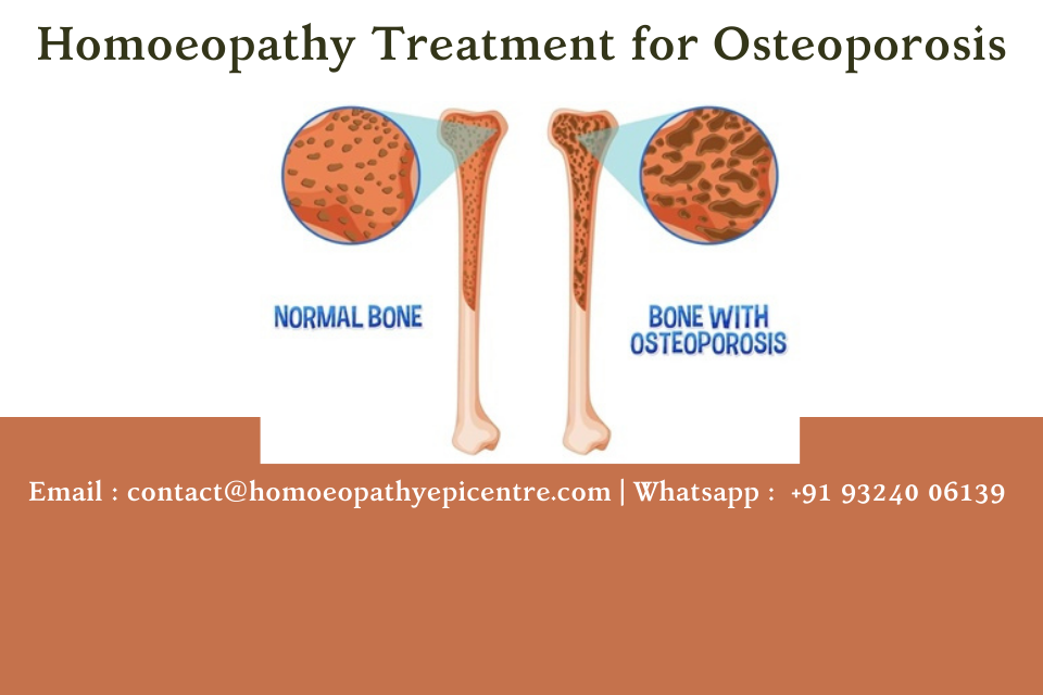 Homoeopathy Treatment for Osteoporosis